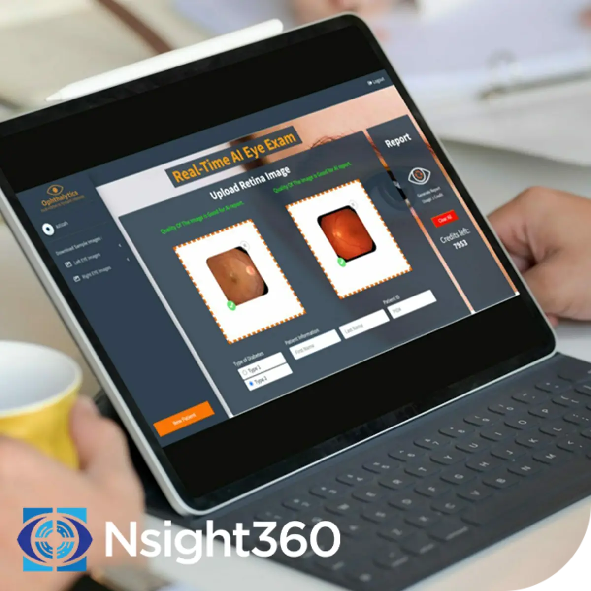 Laptop displaying an AI-assisted retinal scan
