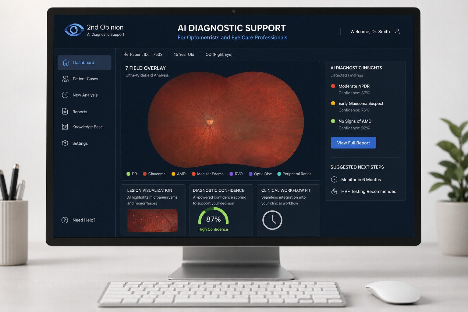 2nd Opinion AI Diagnostic Support — ultra-widefield scan with 7-field overlay